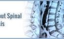 All-About-Spinal-Stenosis-Orange-County-Orthopedic-Center