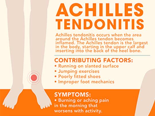 Achilles-Tendonitis-Orange-County-Orthopedic-Center