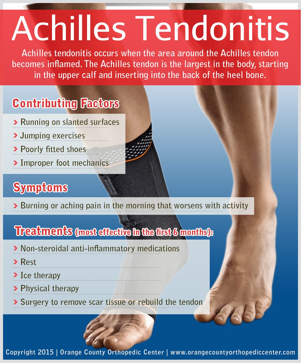  Achilles Tendonitis Orange County Orthopedic Center - Orange County Orthopedic Center