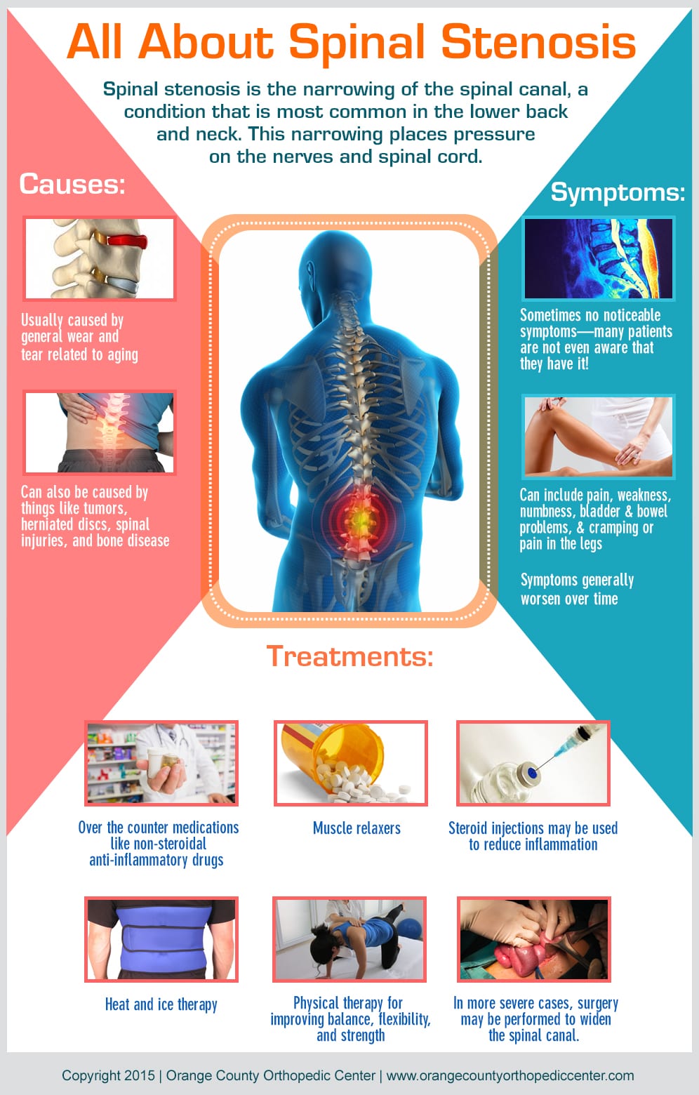 All About Spinal Stenosis Orange County Orthopedic Center - Orange County Orthopedic Center