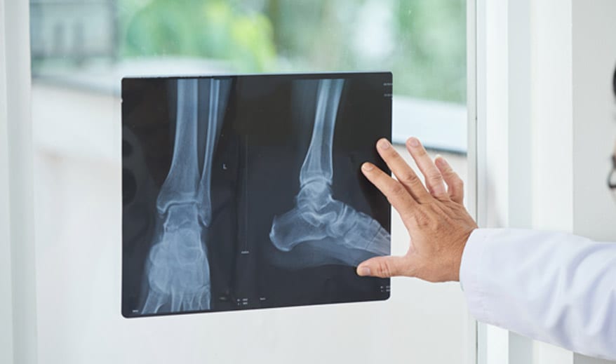 Medical-practitioner-examining-an-X-ray-for-a-fracture