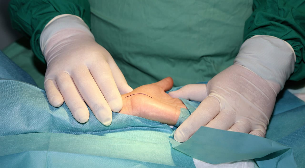 Surgeon-holding-patient’s-hand-after-completed-carpal-tunnel-release-surgery