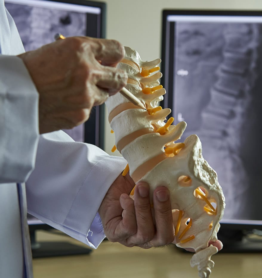 A-spine-surgeon-holding-a-model-of-the-spine