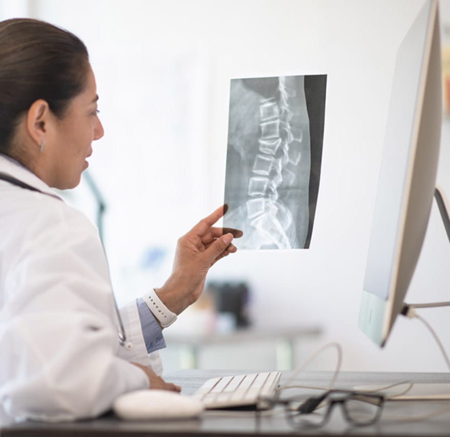 Spine-surgeon-in-Orange-County,-CA-reviewing-spine-x-ray-for-abnormalities