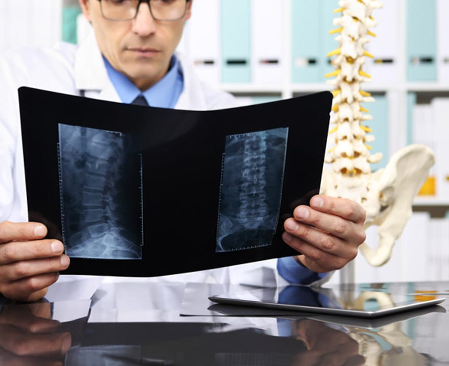 Spine-surgery-specialist-reviewing-x-ray-scan-of-patient’s-spine
